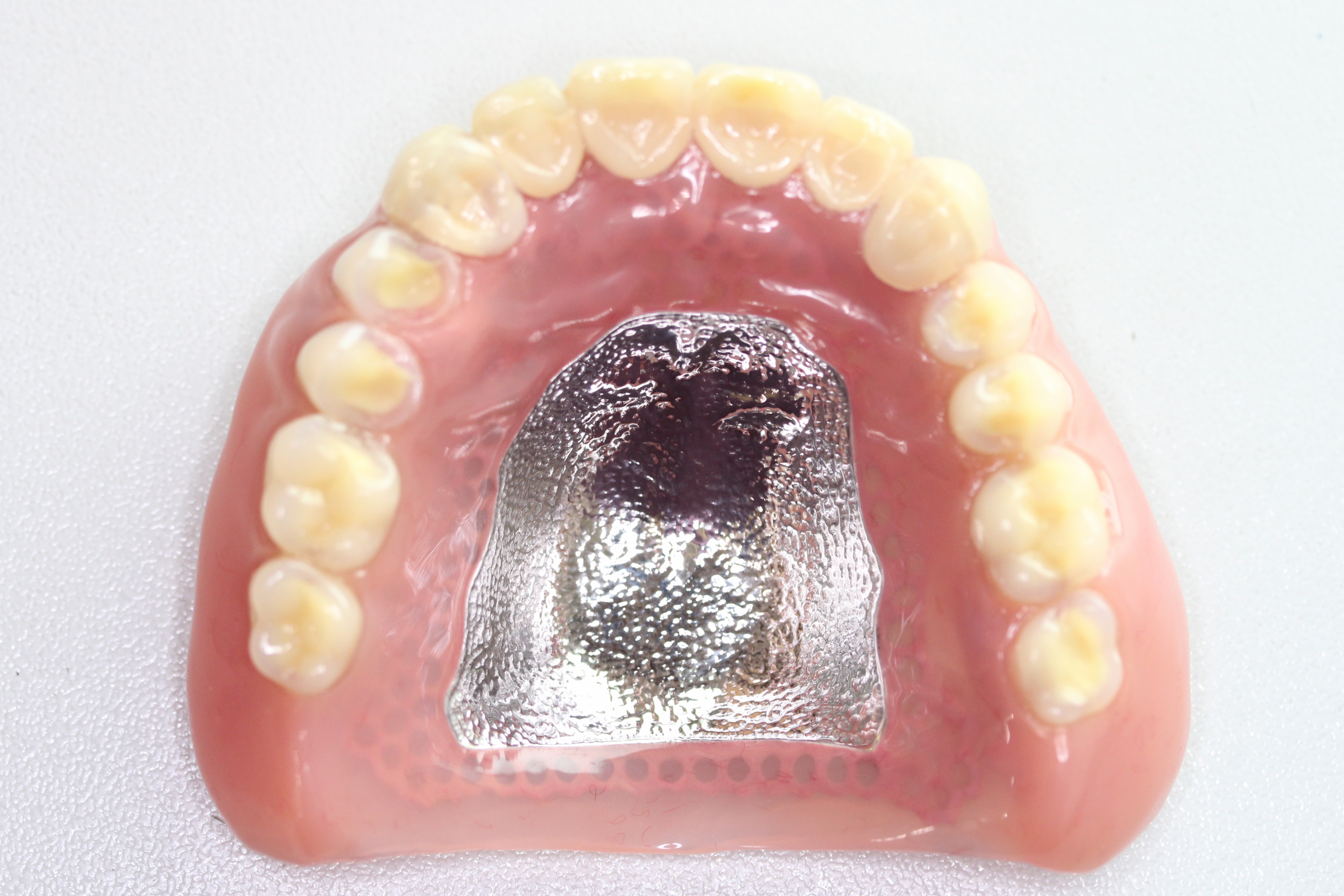 入れ歯の上あごの土台を削ることはできますか？ 東京千代田区のドイツ式入れ歯専門 稲葉歯科医院