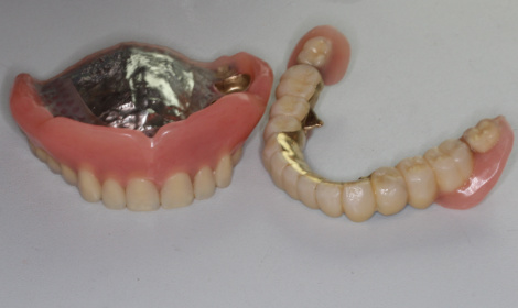 入院中は入れ歯を外しておいた方がいいの?