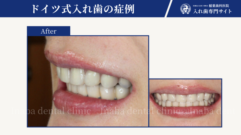 口元をつい隠してしまい、笑うことができない・・・というお悩みをお持ちの方へ