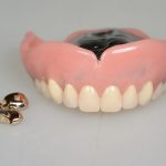 【取り外さない入れ歯】口の中への影響、その他の悪影響はありますか？