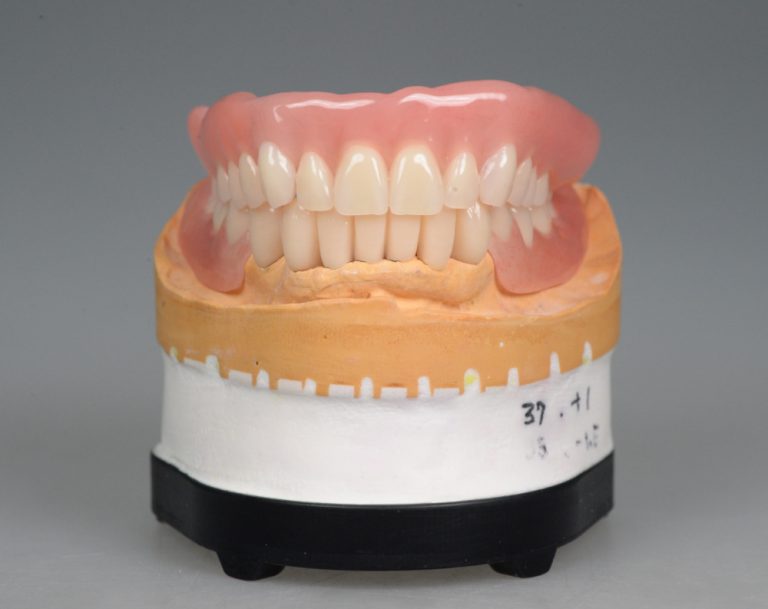 抜歯 から 部分 入れ歯 まで の 期間
