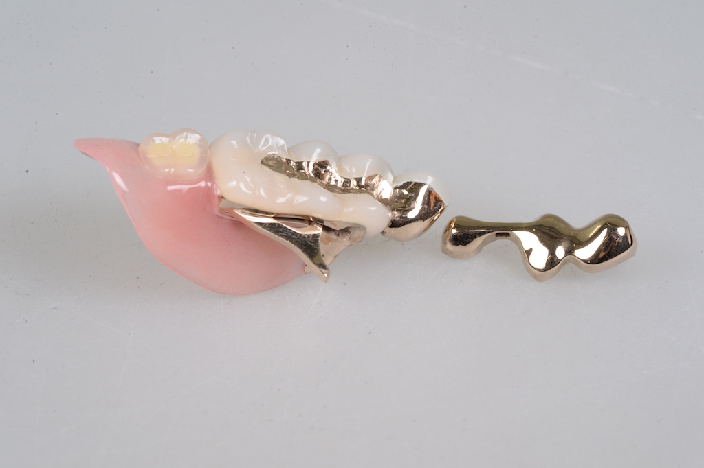 奥歯2本ない方専門ウェブサイト 公開しました!