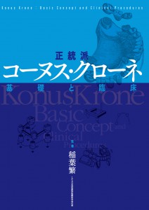 コーヌスクローネとミラクルコーヌスは何が違うのでしょうか。