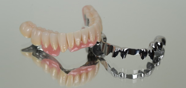 インプラント以外の選択肢 〜テレスコープ義歯〜 ドイツにおける新たな取り組み