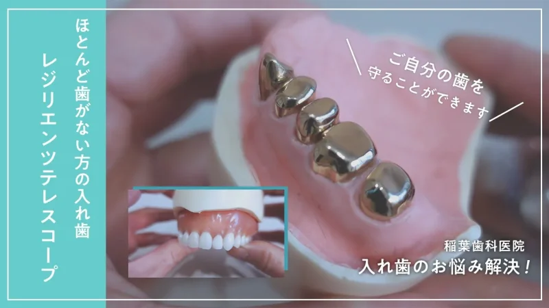 ほとんど歯がない方の入れ歯〜レジリエンツテレスコープ〜